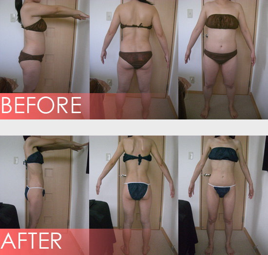 BEFORE & AFTER